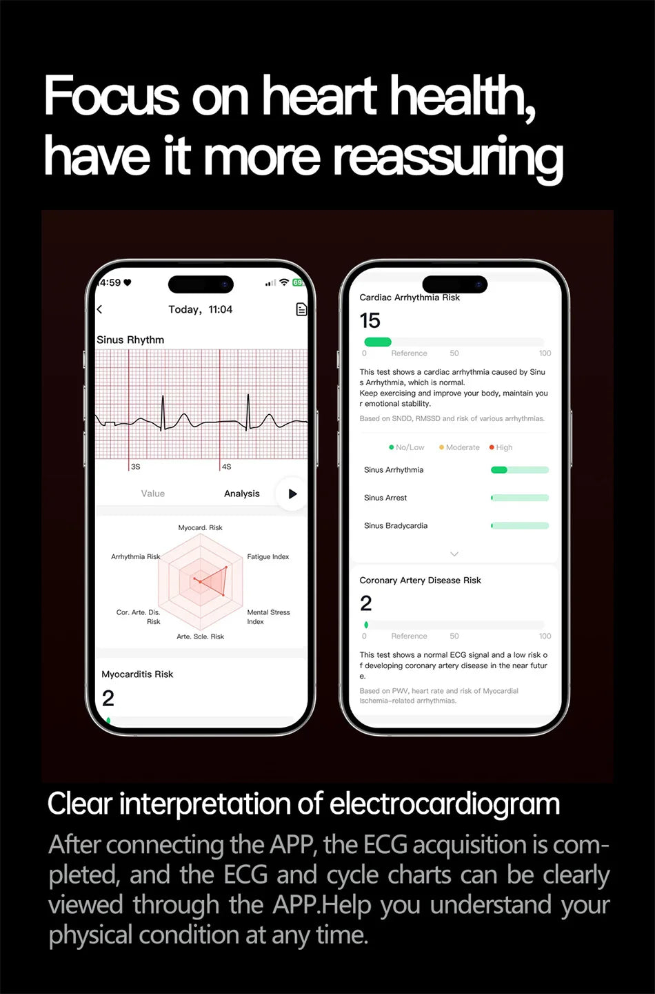 Montre Connectée ECG Health 2025 – Analyse Santé & Diagnostic Intelligent AI